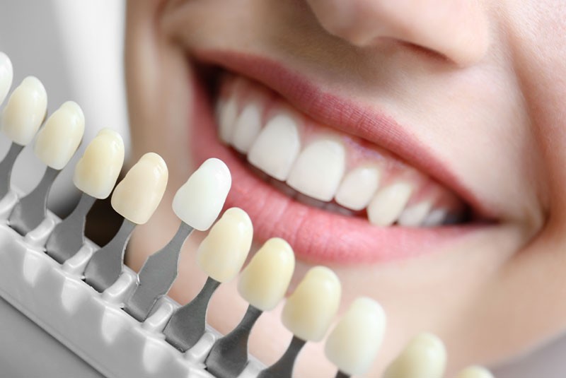 Cosmetic Dentistry Hillsboro OR